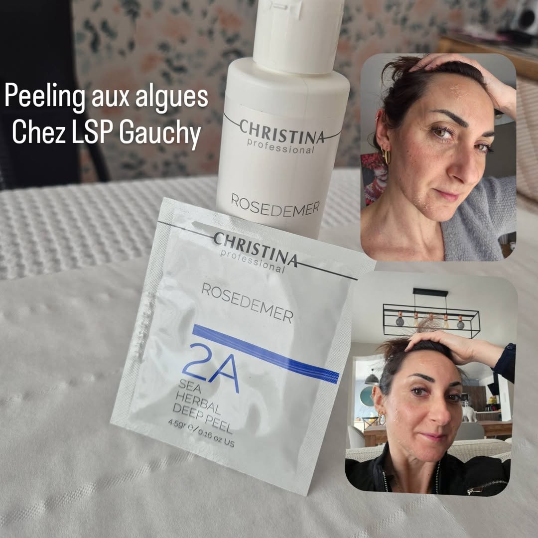 Peeling Christina Professional